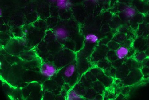 Study reveals how glial cells may play key epilepsy role