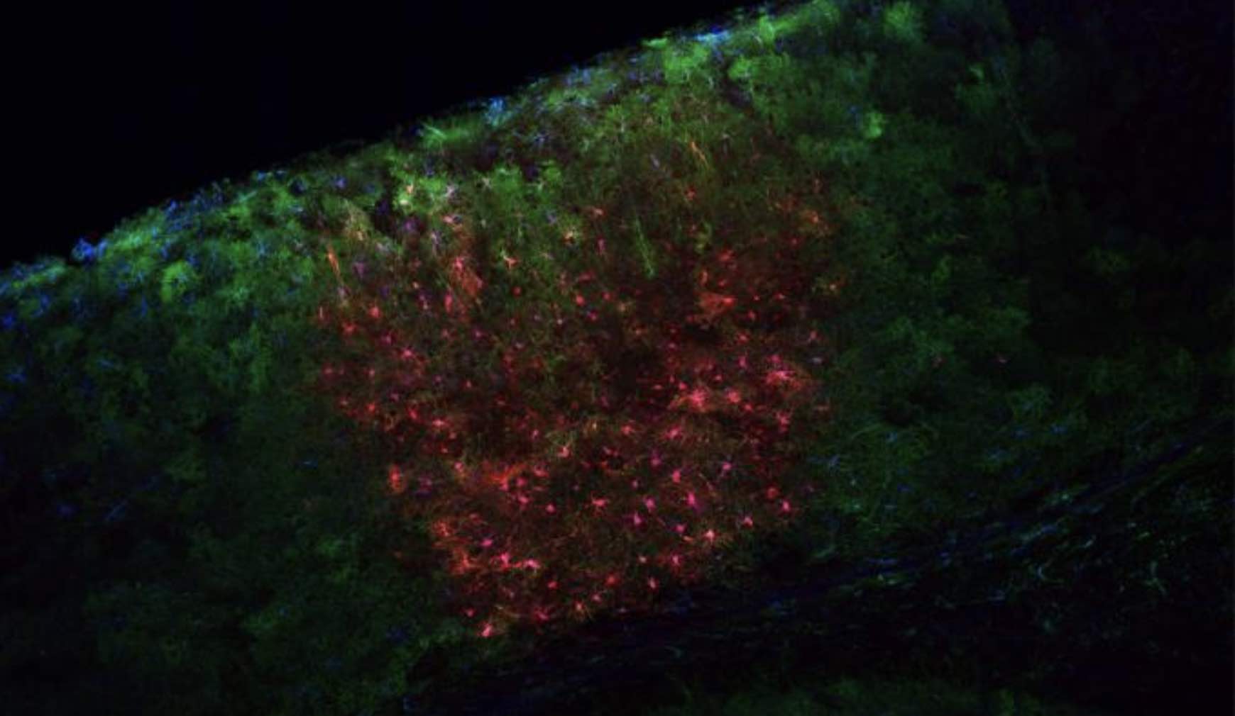 BRAIN grant will fund new tools to study astrocytes