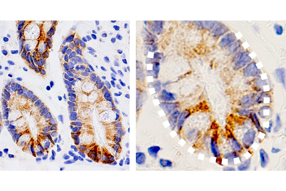 Study links certain metabolites to stem cell function in the intestine