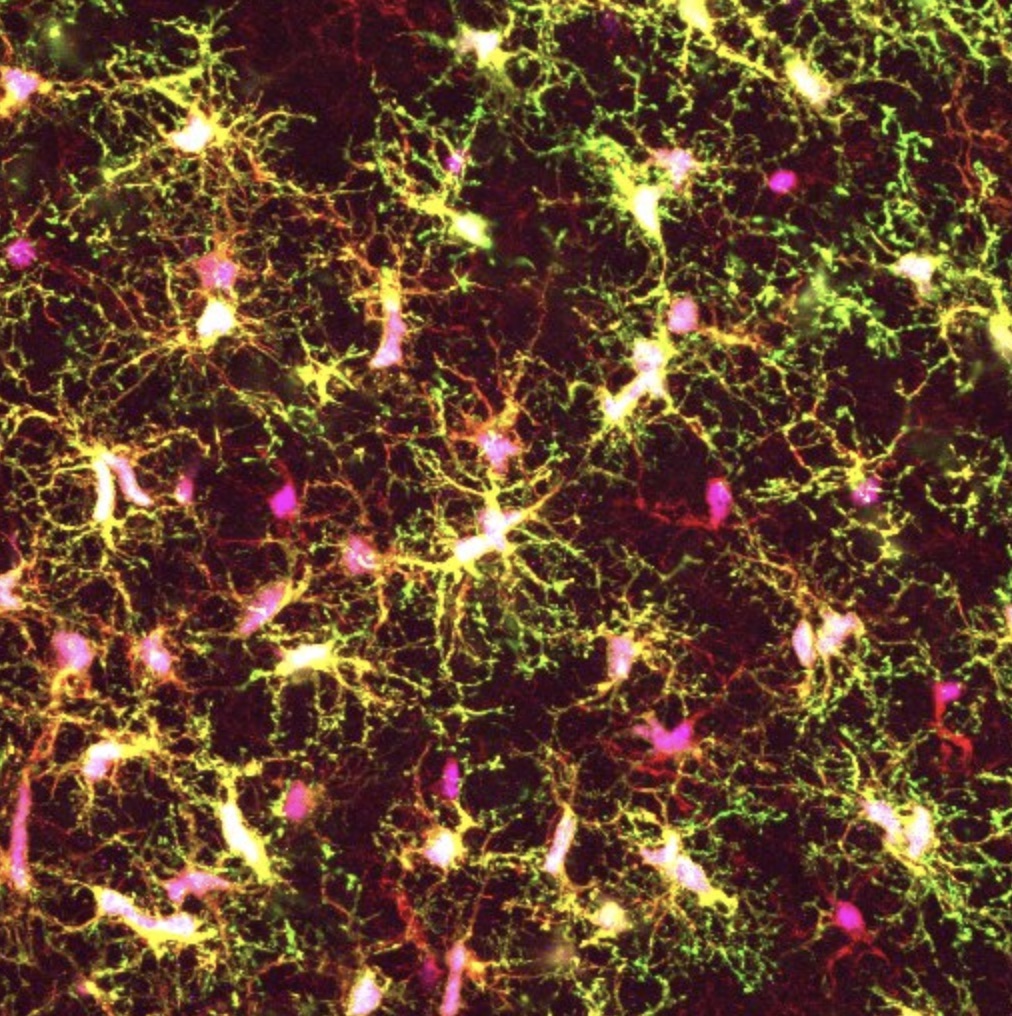 Whitehead Institute team develops new method to study human brain cells