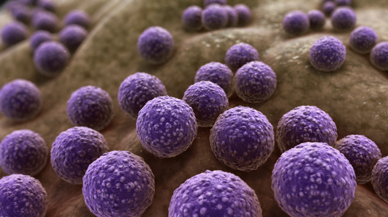 Antibiotic resistance: How to prevent the next public health emergency