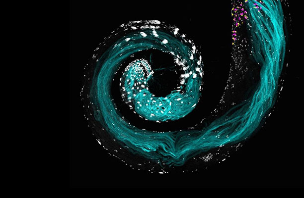 Research Threads: One lab’s detective work reveals secrets of immortal cells