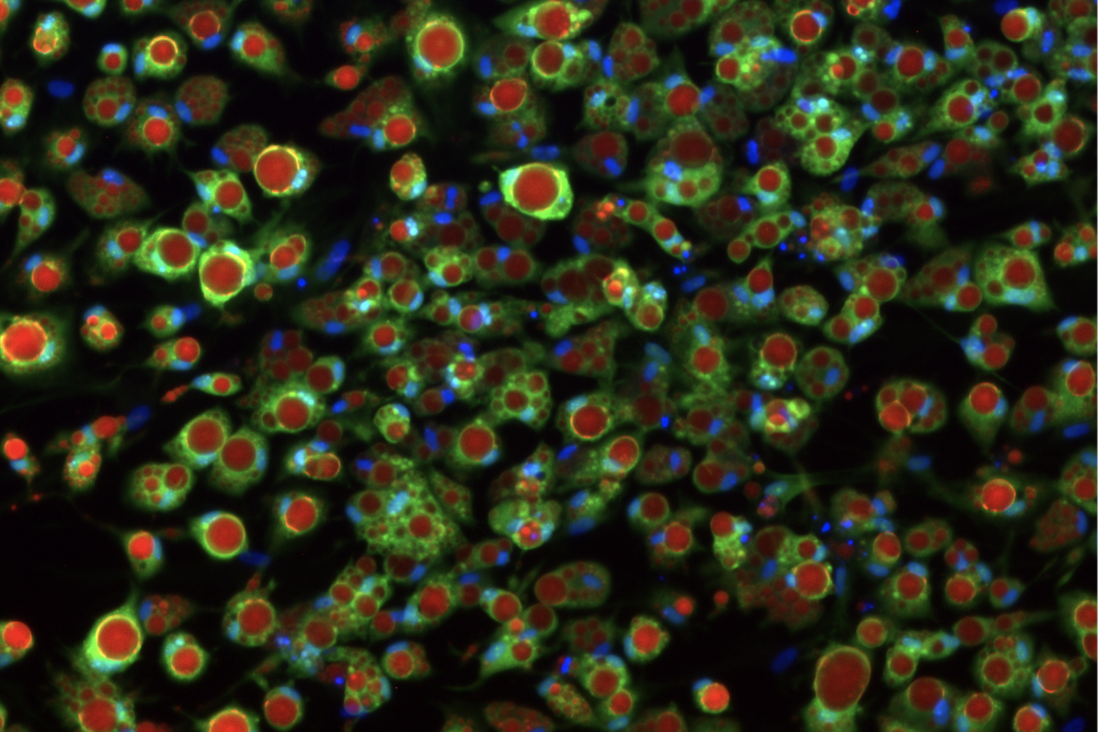 Lab-grown fat cells help scientists understand type 2 diabetes