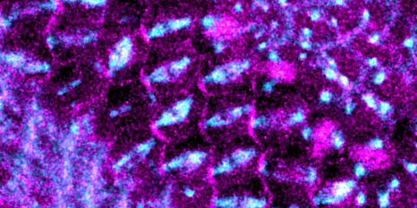 Investigating how cell orientation drives tissue growth during development