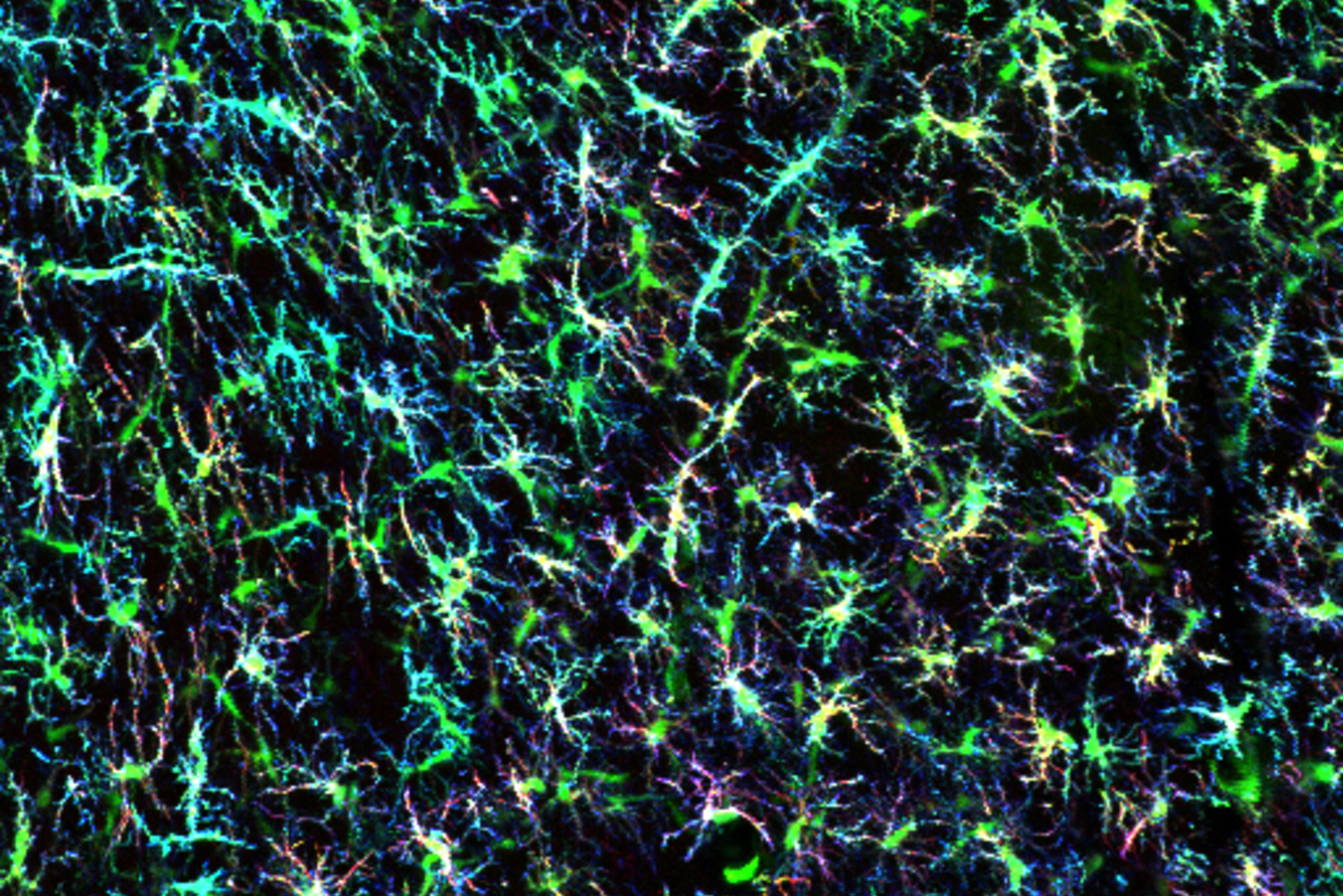 Whitehead Institute researchers uncover a new clue toward understanding the molecular basis of Parkinson’s disease