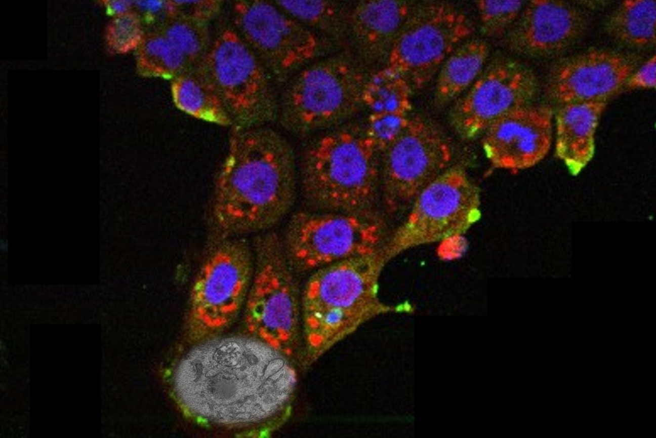 Bat cells possess a unique antiviral mechanism, preventing the SARS-CoV-2 virus from taking control