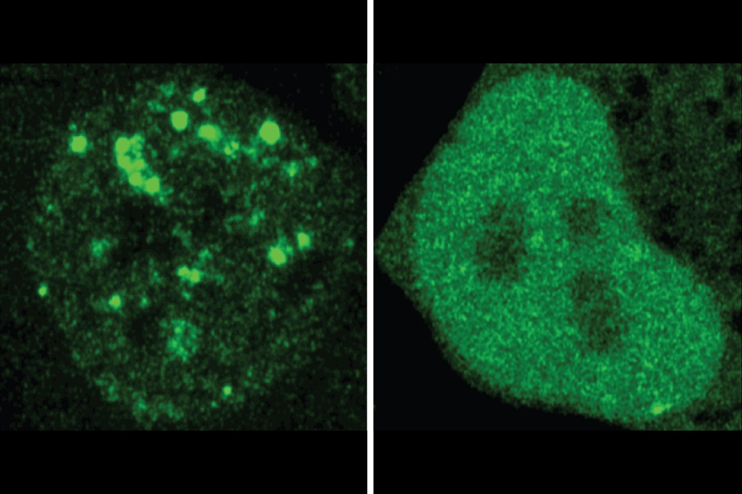 AI model deciphers the code in proteins that tells them where to go