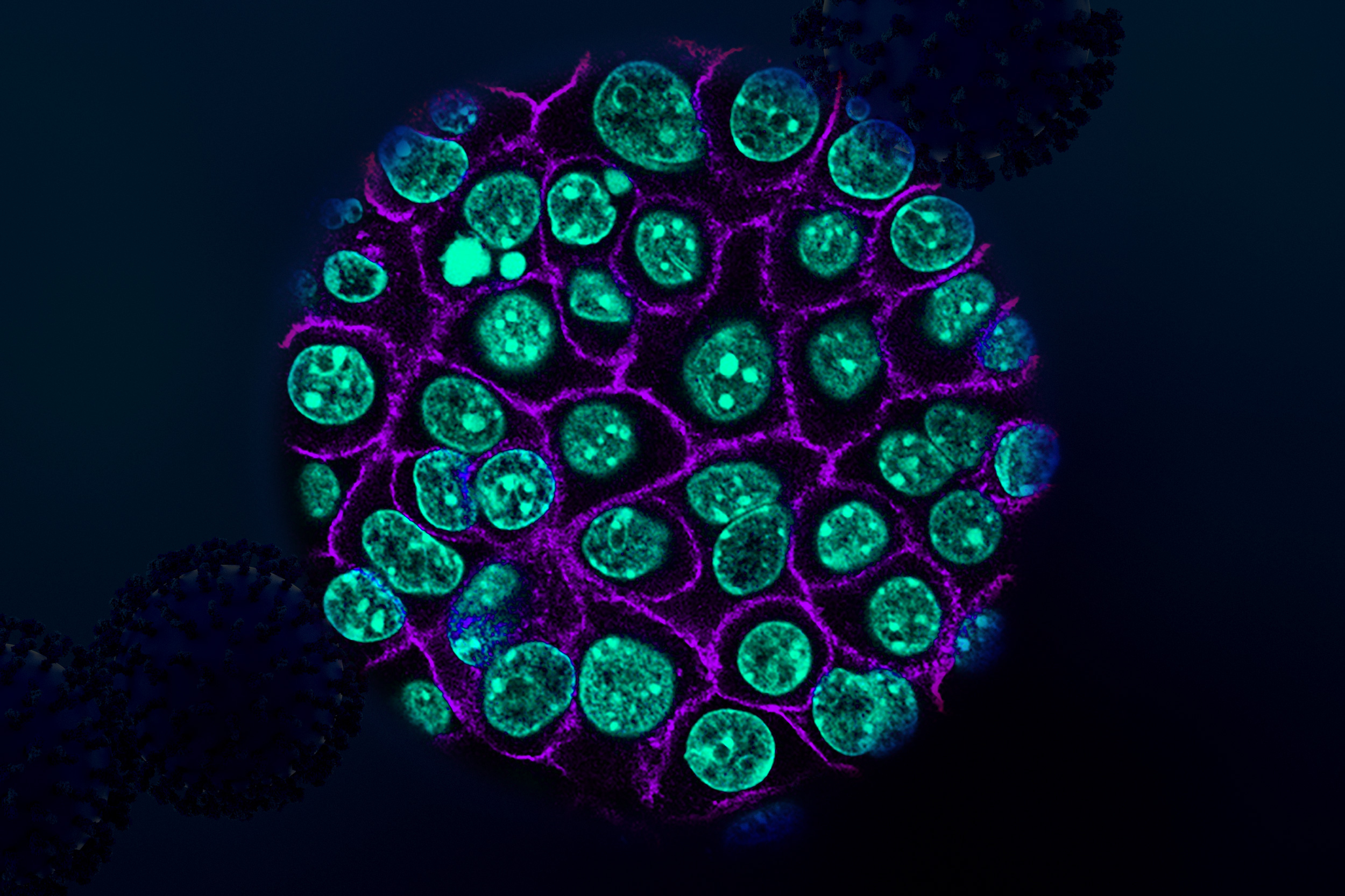 Biologists identify targets for new pancreatic cancer treatments