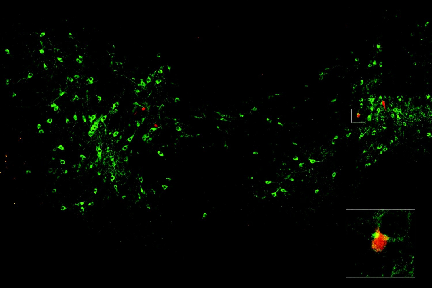 Dopamine signals when a fear can be forgotten