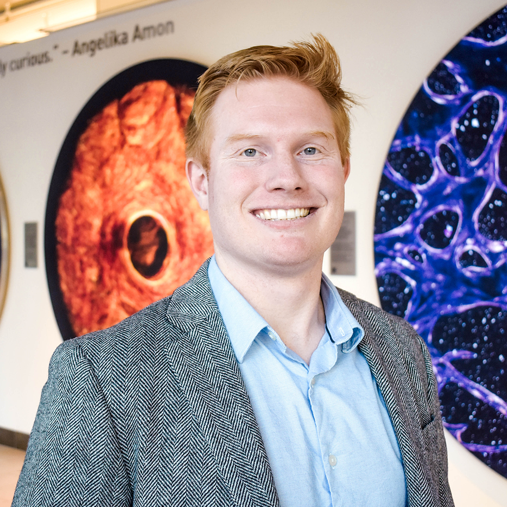 3 Questions with new faculty member Matthew G. Jones: Building predictive models to characterize tumor progression