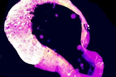 Cells use a little-known molecule to protect themselves from iron overload