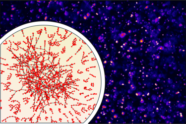 Avoiding a sticky situation: how cells stop messenger RNAs from clumping together