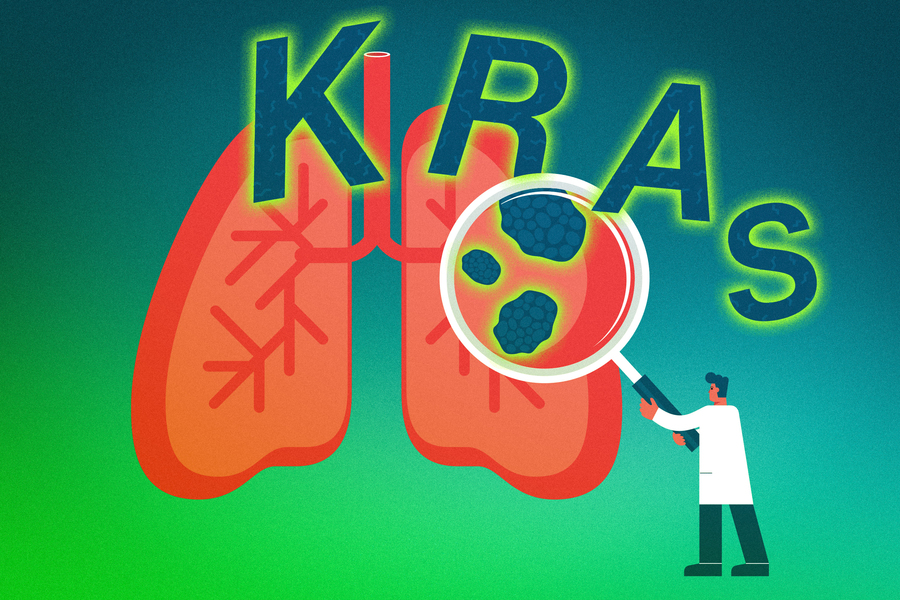 Lung cancers can use two different mechanisms to evade KRAS-inhibiting drugs